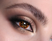 Infected UV Halloween Contact Lenses
